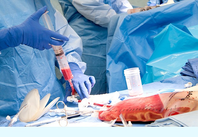 Bone marrow transplant in India
